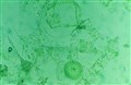 Ostron plankton.jpg